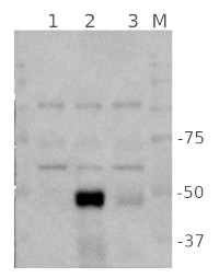 ABI5 | Abscisic acid insensitive 5 (anti-protein antibody) in the group Antibodies Plant/Algal / Hormones / Abscisic acid at Agrisera AB (Antibodies for research) (AS19 4272)